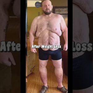 Insane Weight Loss Transformation / Motivation #short