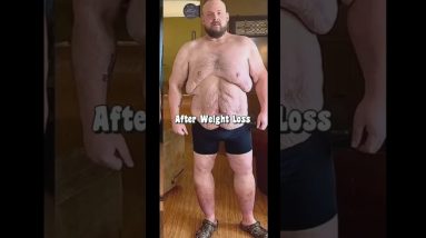 Insane Weight Loss Transformation / Motivation #short