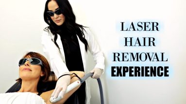 Laser Hair Removal Experience