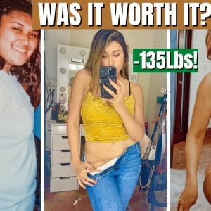 WHAT THEY DON’T TELL YOU ABOUT WEIGHT LOSS & SURGERY! How I lost 135 Lbs on the Keto Diet