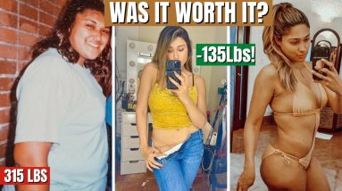 WHAT THEY DON’T TELL YOU ABOUT WEIGHT LOSS & SURGERY! How I lost 135 Lbs on the Keto Diet